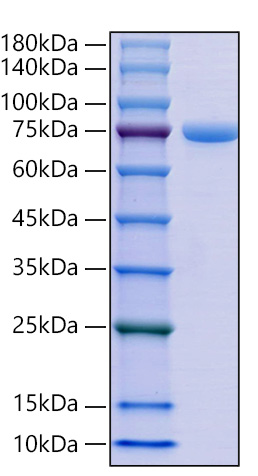 Recombinant Mouse E-Cadherin/CDH1/CD324 Protein was determined by SDS-PAGE under reducing conditions with Coomassie Blue.