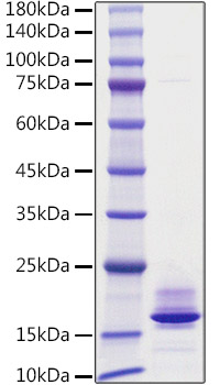 Recombinant Human Calcitonin/CALCA Protein was determined by SDS-PAGE under reducing conditions with Coomassie Blue.