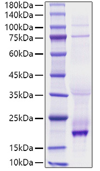 Recombinant Human TNFSF13B/BAFF/CD257 Protein was determined by SDS-PAGE under reducing conditions with Coomassie Blue.