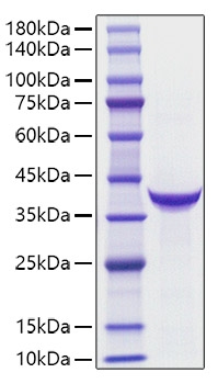 Recombinant Human PG II(PGC) Protein was determined by SDS-PAGE under reducing conditions with Coomassie Blue.
