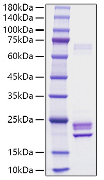 Recombinant Rat IL-1 alpha Protein was determined by SDS-PAGE under reducing conditions with Coomassie Blue.