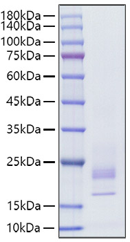 Recombinant Rat IFN-gamma Protein was determined by SDS-PAGE under reducing conditions with Coomassie Blue.