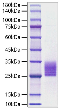 Recombinant Rat IL-6 Protein was determined by SDS-PAGE under reducing conditions with Coomassie Blue.
