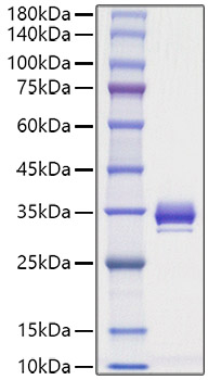 Recombinant Mouse Angiopoietin-1/ANG-1/ANGPT1(277-498) Protein was determined by SDS-PAGE under reducing conditions with Coomassie Blue.