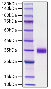 Recombinant Mouse Angiopoietin-2/ANG-2/ANGPT2(275-496) Protein was determined by SDS-PAGE under reducing conditions with Coomassie Blue.