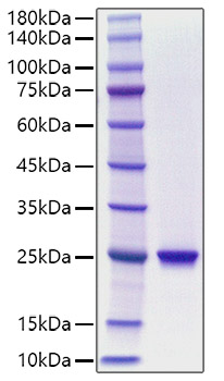 Recombinant Human Chorionic somatomammotropin hormone 1/Choriomammotropin/CSH1 Protein was determined by SDS-PAGE under reducing conditions with Coomassie Blue.