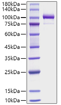 Recombinant Human Periostin/PN/POSTN Protein was determined by SDS-PAGE under reducing conditions with Coomassie Blue.