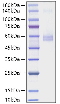 Recombinant Mouse TNFSF13/APRIL/CD256 Protein was determined by SDS-PAGE under reducing conditions with Coomassie Blue.