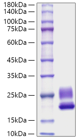 Recombinant Rat IL-21 Protein was determined by SDS-PAGE under reducing conditions with Coomassie Blue.