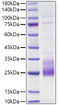 Recombinant Human IL-31 Protein was determined by SDS-PAGE under reducing conditions with Coomassie Blue.