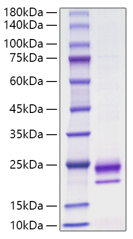 Recombinant Mouse IL-36 gamma/IL-1F9 Protein was determined by SDS-PAGE under reducing conditions with Coomassie Blue.