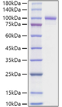 Recombinant Mouse Periostin/PN/POSTN Protein was determined by SDS-PAGE under reducing conditions with Coomassie Blue.