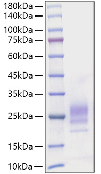 Recombinant Mouse IL-7 Protein was determined by SDS-PAGE under reducing conditions with Coomassie Blue.