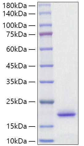Recombinant Rat IL-2 Protein was determined by SDS-PAGE under reducing conditions with Coomassie Blue.