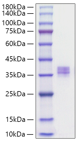 Recombinant Human MMP-7 Protein was determined by SDS-PAGE under reducing conditions with Coomassie Blue.