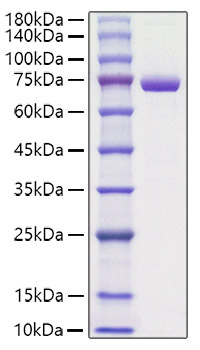 Recombinant Mouse Periostin/PN/POSTN Protein was determined by SDS-PAGE under reducing conditions with Coomassie Blue.