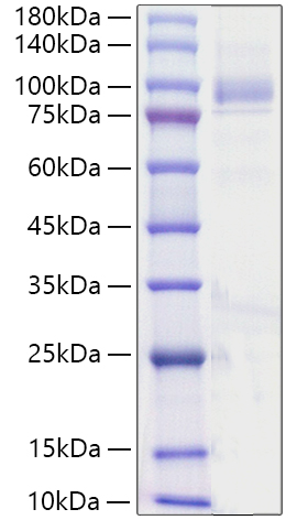 Recombinant Human Angiopoietin-4/ANG-4/ANGPT4(23-503) Protein was determined by SDS-PAGE under reducing conditions with Coomassie Blue.
