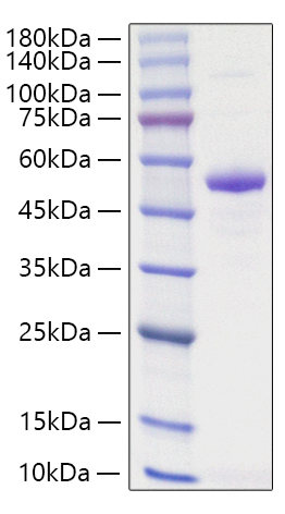 Recombinant Human TNFSF13/APRIL/CD256 Protein was determined by SDS-PAGE under reducing conditions with Coomassie Blue.