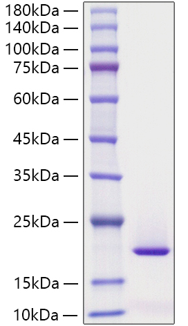 Recombinant Human MYDGF Protein was determined by SDS-PAGE under reducing conditions with Coomassie Blue.