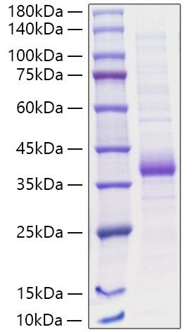 Recombinant Human Carbonic anhydrase 5A/CA5A Protein was determined by SDS-PAGE under reducing conditions with Coomassie Blue.