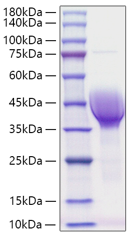 Recombinant Human CER1/DAND4 Protein was determined by SDS-PAGE under reducing conditions with Coomassie Blue.
