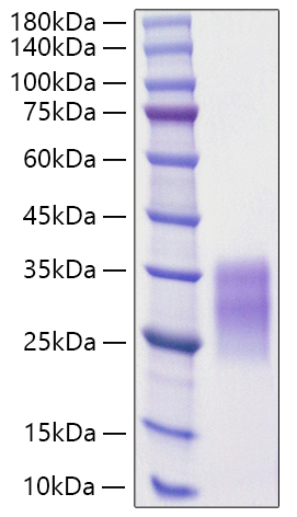 Recombinant Rat c-Kit ligand/KITLG/SCF Protein was determined by SDS-PAGE under reducing conditions with Coomassie Blue.