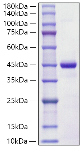 Recombinant Human S100-A7 Protein was determined by SDS-PAGE under reducing conditions with Coomassie Blue.