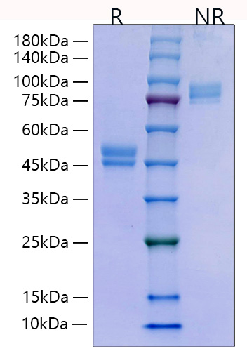 Recombinant Human WFDC2/HE4/WAP5 Protein was determined by SDS-PAGE under reducing (R) and non-reducing (NR) conditions.