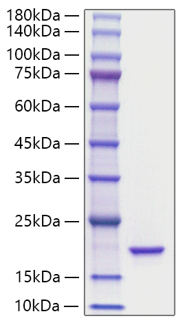 Recombinant Mouse IL-36Ra/IL-1F5 Protein was determined by SDS-PAGE under reducing conditions with Coomassie Blue.