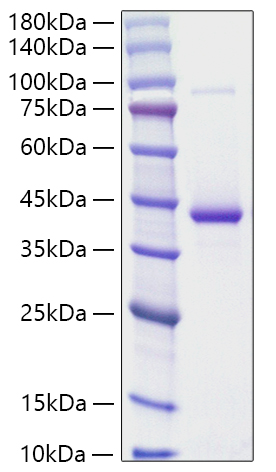 Recombinant Human RETN Protein was determined by SDS-PAGE under reducing conditions with Coomassie Blue.