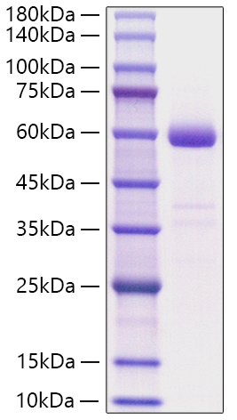 Recombinant Human NBL1 Protein was determined by SDS-PAGE under reducing conditions with Coomassie Blue.