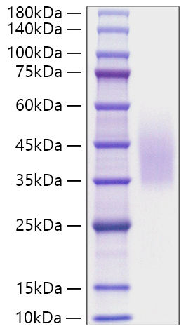 Recombinant Human CD320 Protein was determined by SDS-PAGE under reducing conditions with Coomassie Blue.