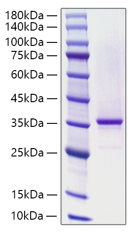 Recombinant Human KLHL20 Protein was determined by SDS-PAGE under reducing conditions with Coomassie Blue.