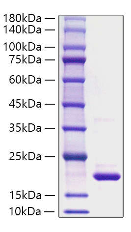 Recombinant Rat IL-1Ra/IL-1F3/IL-1RN Protein was determined by SDS-PAGE under reducing conditions with Coomassie Blue.
