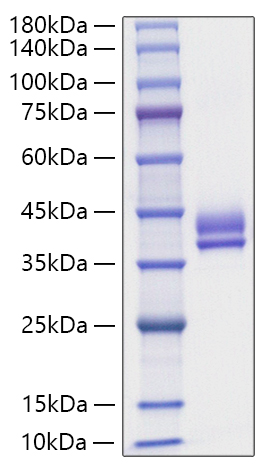 Recombinant Human Gastric inhibitory polypeptide/GIP Protein was determined by SDS-PAGE under reducing conditions with Coomassie Blue.