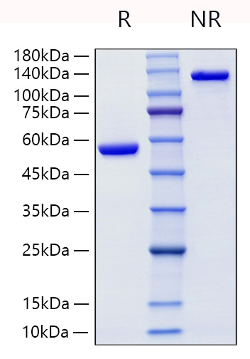 Recombinant Human Lipocalin-2/NGAL/LCN2 Protein was determined by SDS-PAGE under reducing (R) and non-reducing (NR) conditions.