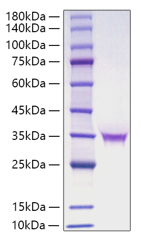 Recombinant Human FGF-18 Protein was determined by SDS-PAGE under reducing conditions with Coomassie Blue.