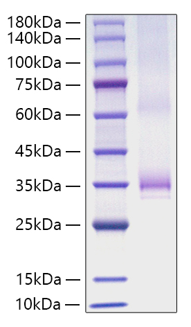 Recombinant Human Angiopoietin-1/ANG-1/ANGPT1(277-498) Protein was determined by SDS-PAGE under reducing conditions with Coomassie Blue.