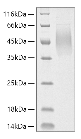 Recombinant Human MUC-16/CA125 Protein was determined by SDS-PAGE under reducing conditions with Coomassie Blue.