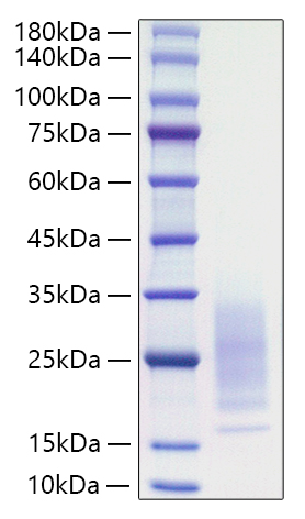 Recombinant Mouse IL-31 Protein was determined by SDS-PAGE under reducing conditions with Coomassie Blue.