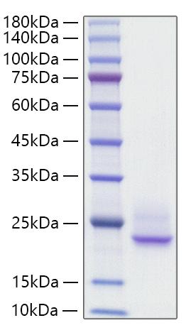 Recombinant Rat IFNA1 Protein was determined by SDS-PAGE under reducing conditions with Coomassie Blue.