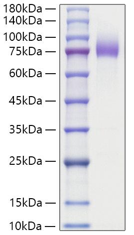 Recombinant Human MUC-16/CA125 Protein was determined by SDS-PAGE under reducing conditions with Coomassie Blue.