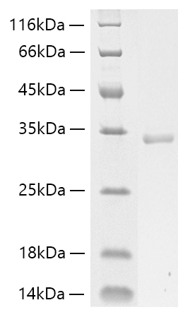 Recombinant Human Collagen I alpha 1/COL1A1 Protein was determined by SDS-PAGE under reducing conditions with Coomassie Blue.