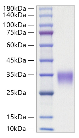 Recombinant Rat Oncostatin-M/OSM Protein was determined by SDS-PAGE under reducing conditions with Coomassie Blue.