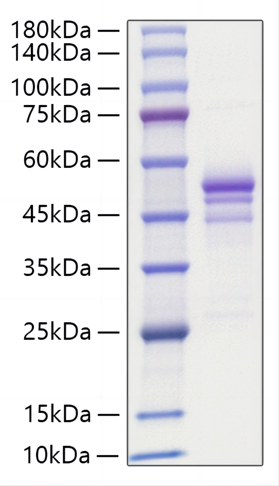 Recombinant Human Gastrin-releasing peptide/GRP Protein was determined by SDS-PAGE under reducing conditions with Coomassie Blue.