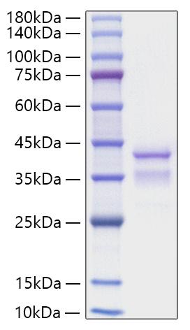 Recombinant Mouse TGF-alpha Protein was determined by SDS-PAGE under reducing conditions with Coomassie Blue.