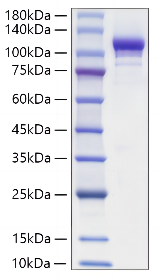 Recombinant Mouse Autotaxin/E-NPP2 Protein was determined by SDS-PAGE under reducing conditions with Coomassie Blue.