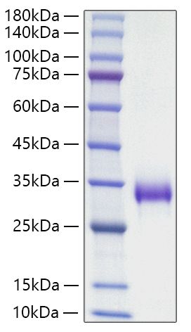 Recombinant Mouse TIMP-1 Protein was determined by SDS-PAGE under reducing conditions with Coomassie Blue.