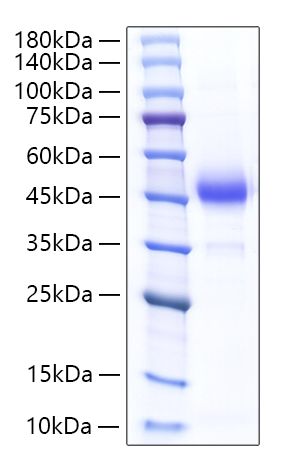 Recombinant Rat ALK-4/ACVR1B Protein was determined by SDS-PAGE under reducing conditions with Coomassie Blue.
