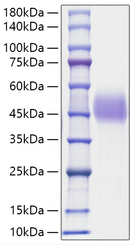 Recombinant Human C1QC Protein was determined by SDS-PAGE under reducing conditions with Coomassie Blue.